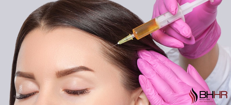PRP for hair loss before and after